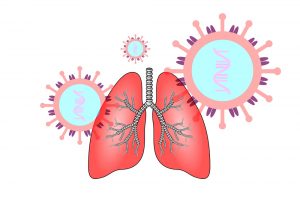 DEGUM empfiehlt Lungenultraschall bei Verdacht auf COVID-19-Pneumonie