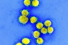Neuer SARS-CoV-2 neutralisierender Antikörper wird klinisch geprüft
