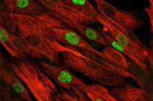 Meilenstein für Therapie der Muskeldystrophie