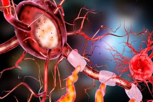 Orale Therapie der spinalen Muskelatrophie bald verfügbar?