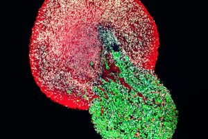 Europäischer Forschungsrat fördert Entwicklung neuromuskulärer Organoide