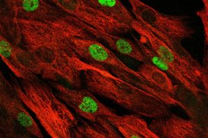 Meilenstein für Therapie der Muskeldystrophie