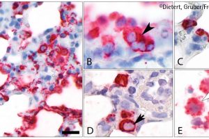 Lungenschäden bei COVID-19-Erkrankungen verstehen. Modell als Grundlage neuer therapeutischer Ansätze