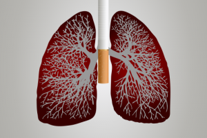 Forschungsprojekt evaluiert Verfahren zur Lungenkrebs-Früherkennung
