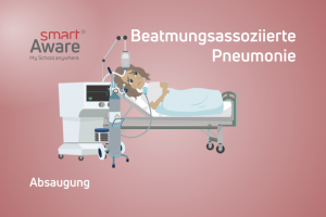 Jetzt online schulen: Absaugung im Kontext beatmungs-assoziierter Pneumonien