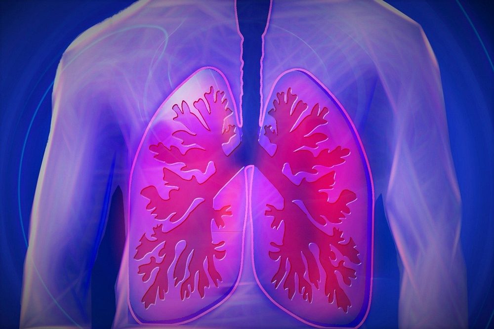 Bei schwerer Lungenentzündung kann kurzfristige Cortison-Therapie Beatmung und Tod verhindern