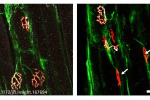 ALS-Studie zur Rolle der neuronalen Erregbarkeit für den Krankheitsverlauf - Genregulator SRF schützt Motoneuronen