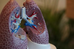 Epigenetisches „Profiling“ identifiziert potenzielle Ziele für die Behandlung der COPD