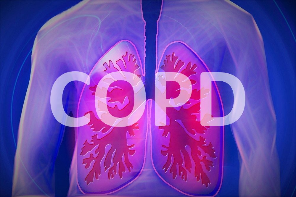 Die Lungenerkrankung COPD besser verstehen und behandeln