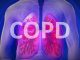 Die Lungenerkrankung COPD besser verstehen und behandeln