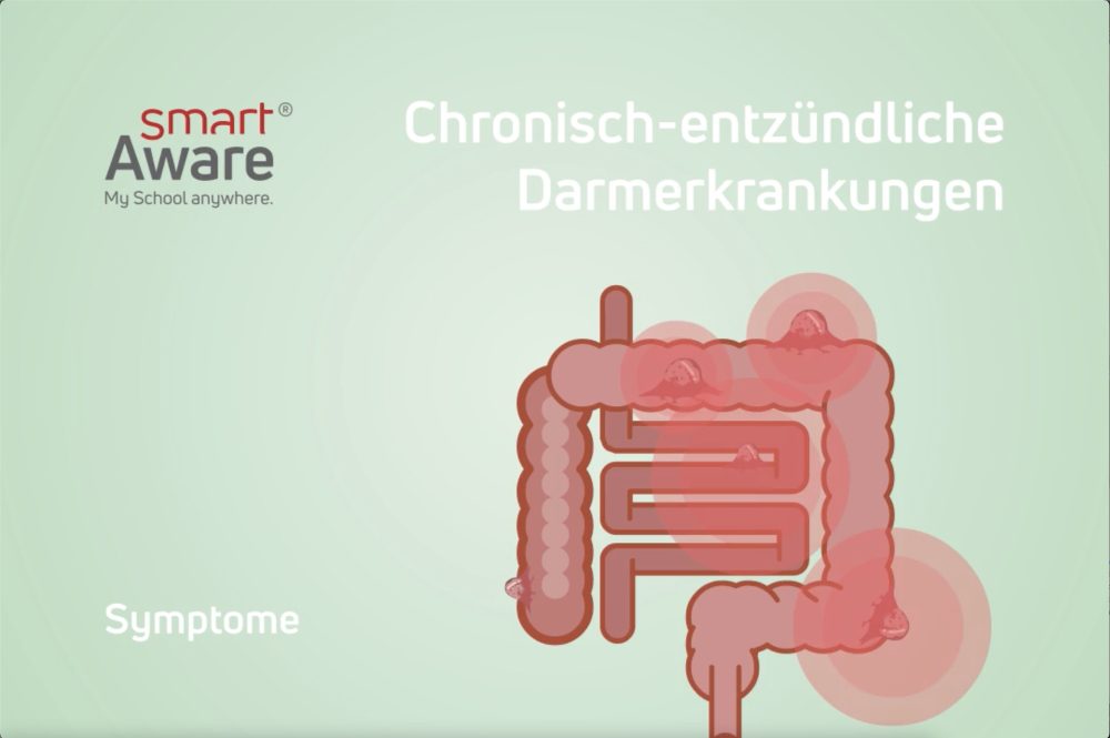 Jetzt online schulen: Krankheitsbild und Pflege bei Morbus Crohn und Colitis Ulcerosa