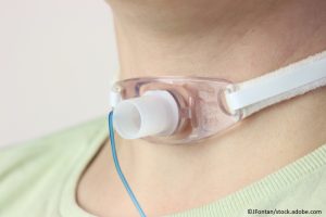 Entscheidung auf der Intensivstation: Wie gelingt die erfolgreiche Entwöhnung vom Beatmungsgerät?
