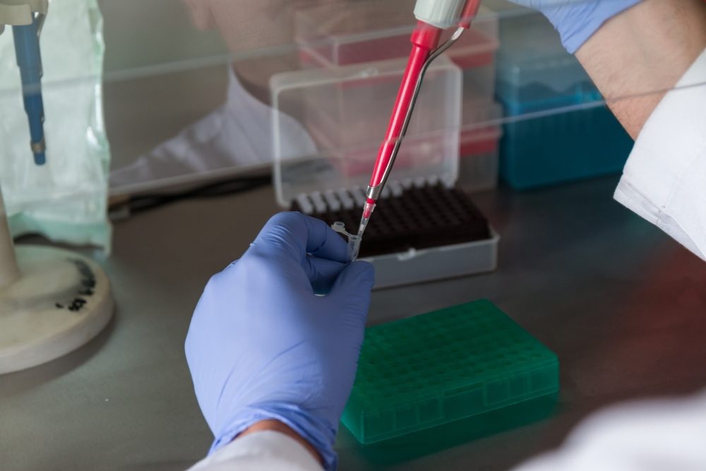 ALS – einfachere und zuverlässige Diagnose mit Bluttests