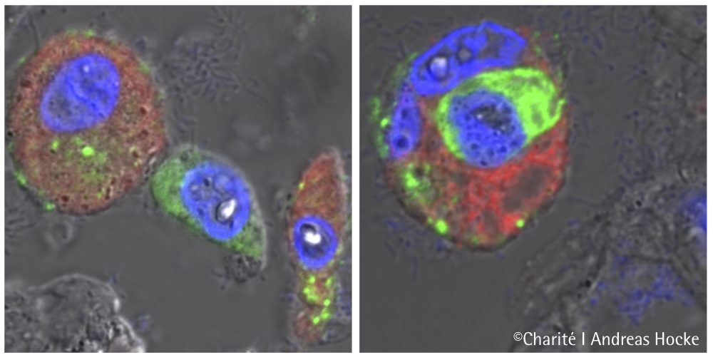 SARS-CoV-2-Studie zum Infektionsmechanismus in den Lungenbläschen