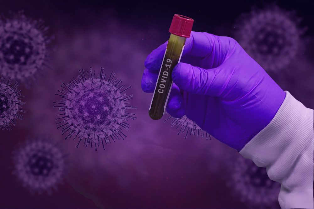 COVID-19: In Deutschland werden nur 15 Prozent der SARS-Cov-2-Infektionen erkannt