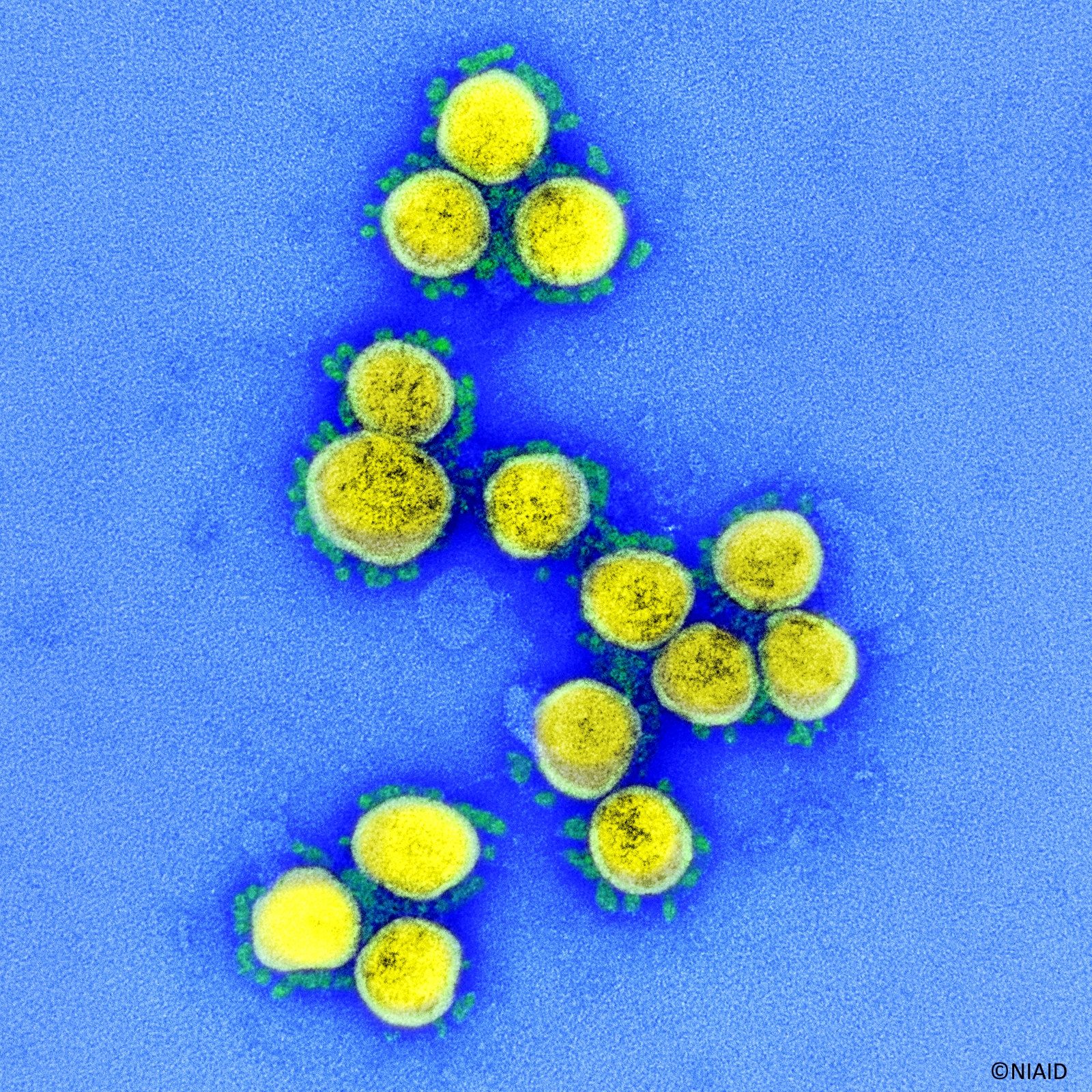 Neuer SARS-CoV-2 neutralisierender Antikörper wird klinisch geprüft
