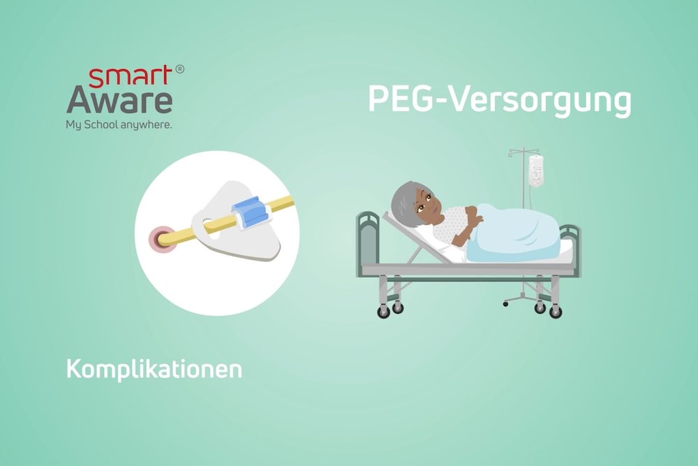 Jetzt online schulen: PEG-Versorgung