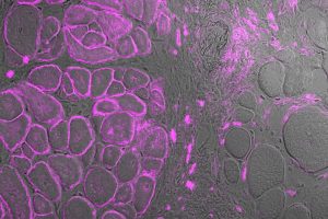 Mit CRISPR gegen Muskelschwund