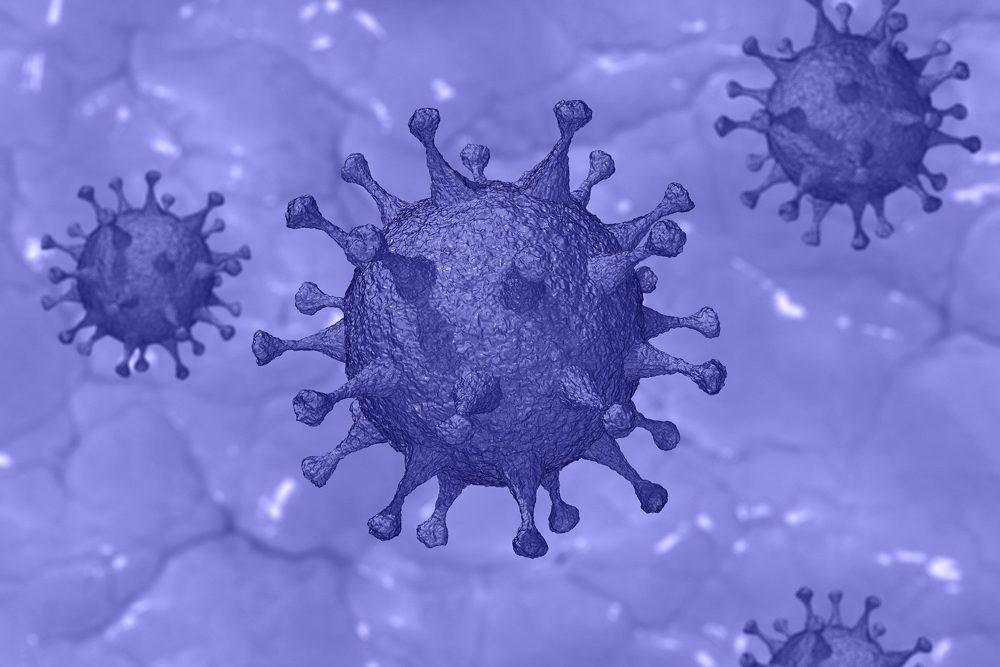 SARS-CoV-2 kann das gefürchtete Guillain-Barré-Syndrom auslösen