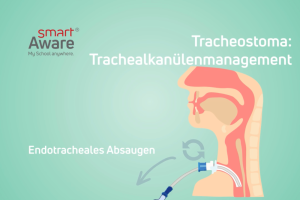 Jetzt online schulen: Endotracheales Absaugen