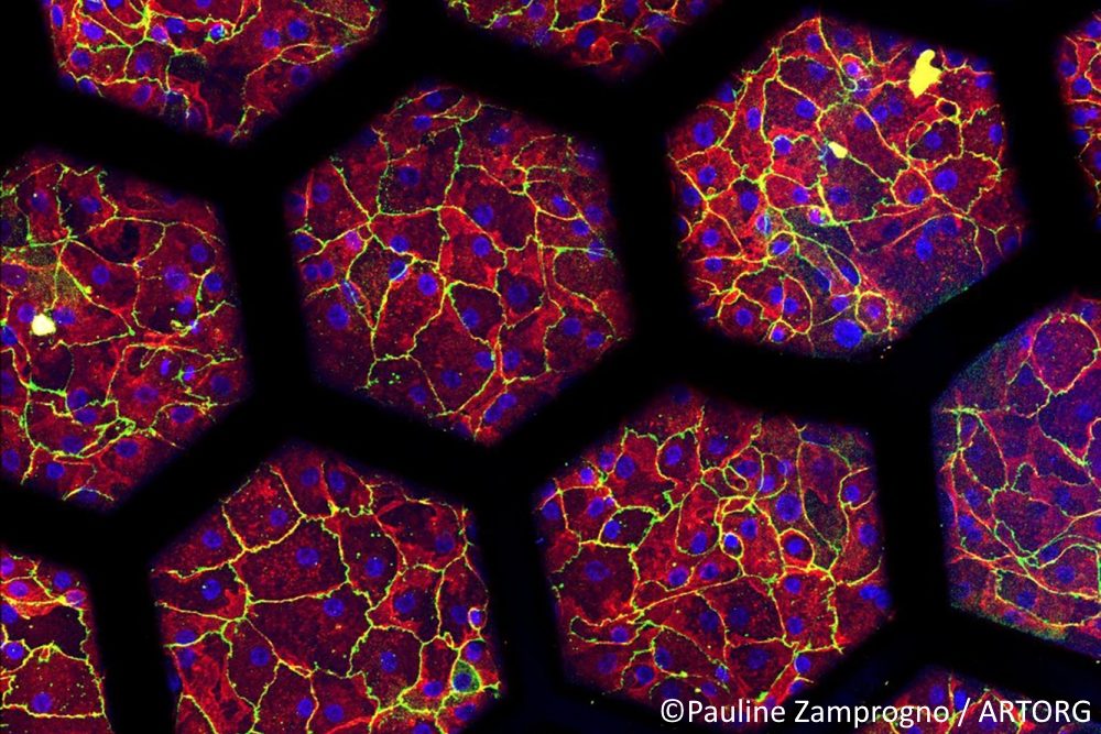 Berner Forschende bauen hochentwickelte „Lunge auf Chip“