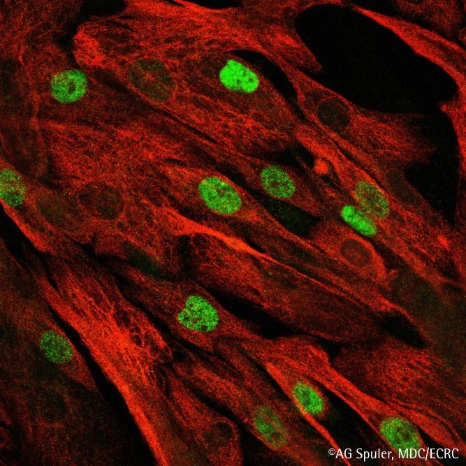 Meilenstein für Therapie der Muskeldystrophie