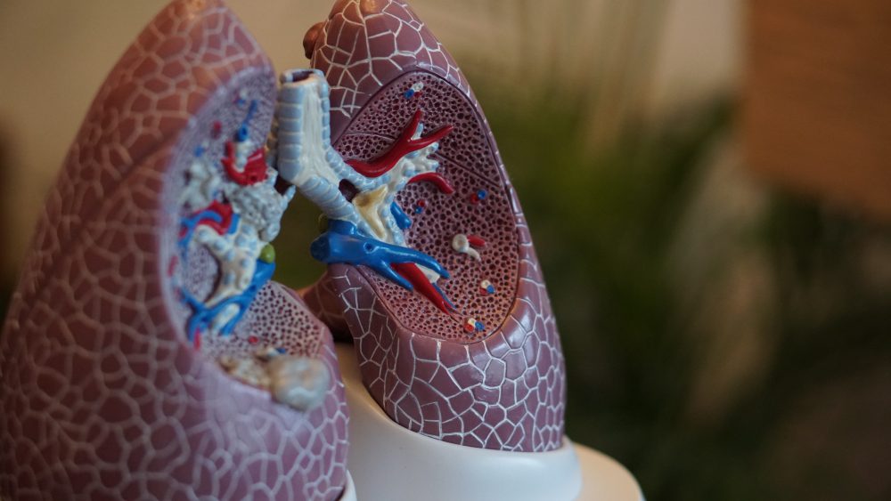 Epigenetisches „Profiling“ identifiziert potenzielle Ziele für die Behandlung der COPD