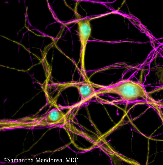Das zelluläre Postleitzahlsystem entschlüsseln
