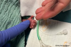 Intelligentes Absaugsystem schützt Frühgeborene