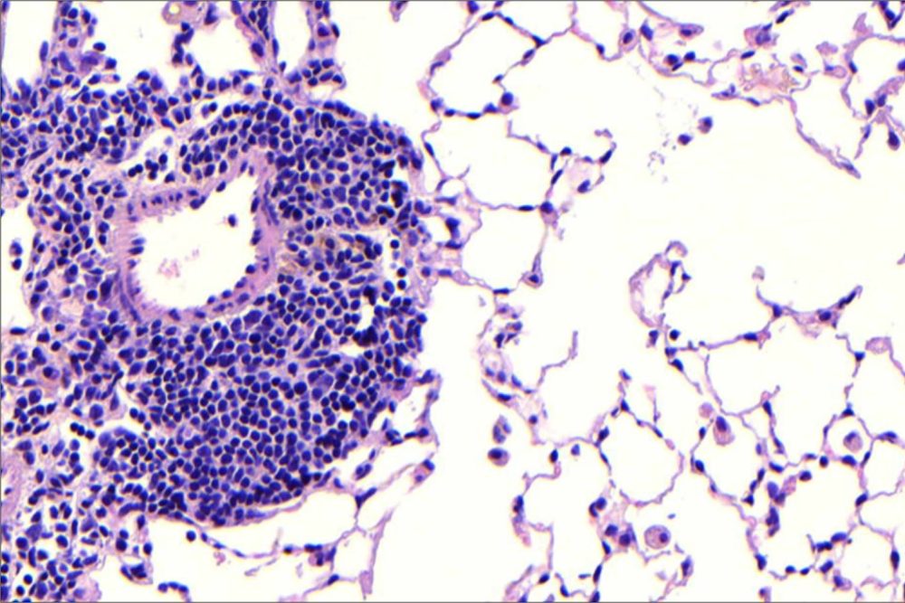 Aussichtsreicher Therapieansatz gegen COPD