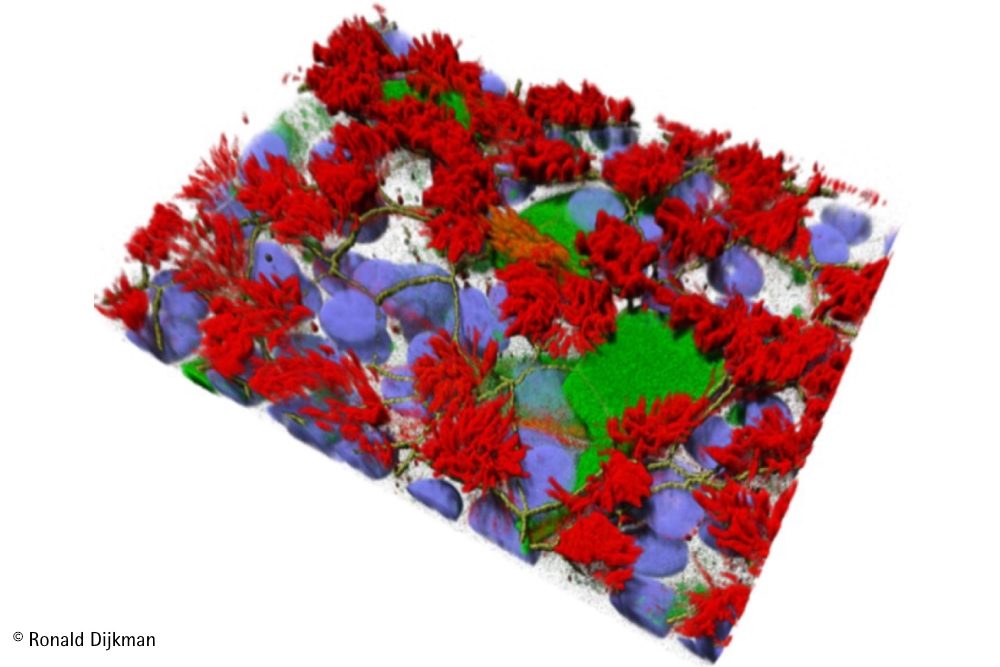 Warum sich SARS-CoV-2 in den oberen Atemwegen besser vermehrt
