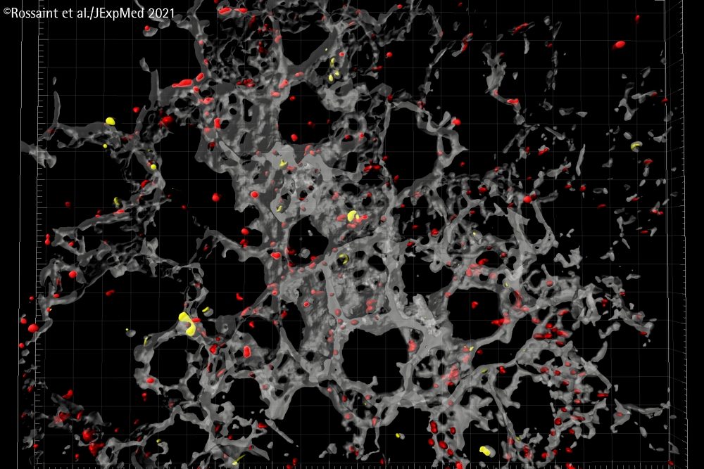 Forscher zeigen, wie Blutplättchen helfen, eine Lungenentzündung aufzulösen