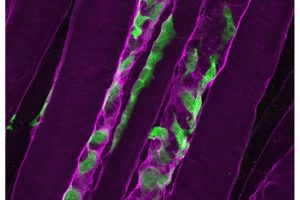 Angeborene Muskelschwäche: Muskeln können sich nicht regenerieren