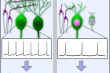 Neue Erkenntnisse zur Rolle des Kleinhirns bei spinaler Muskelatrophie
