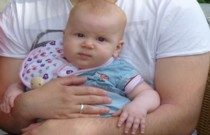 Tuberkulose bei Kindern bald besser zu erkennen