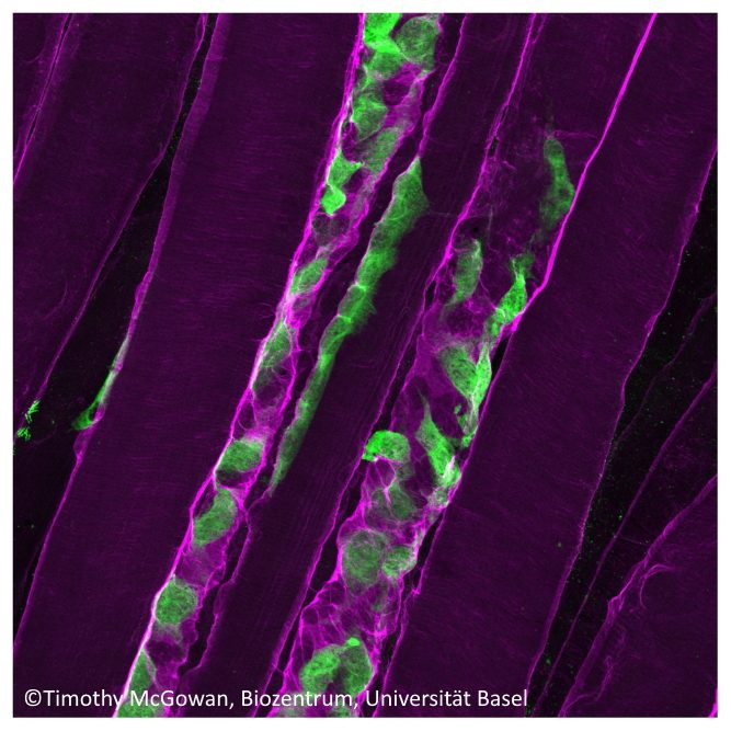 Angeborene Muskelschwäche: Muskeln können sich nicht regenerieren