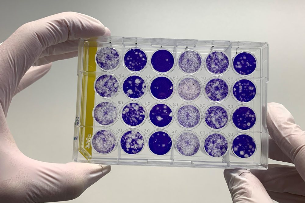 Coronavirus: Virologische Details zur Münchner Fallgruppe