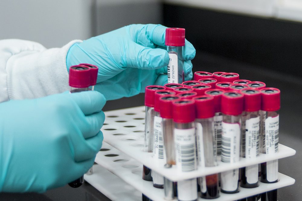 Wie viele Menschen sind immun gegen das neue Coronavirus? Robert Koch-Institut startet bundesweite Antikörper-Studien