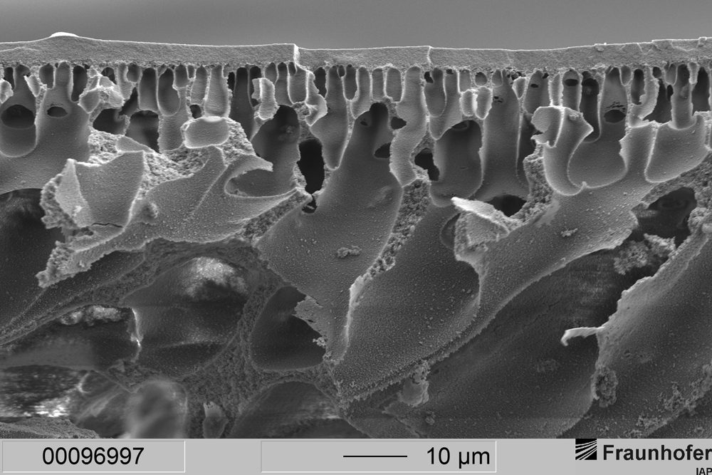 Polymer-Membranen erleichtern Sauerstoffaustausch im Körper