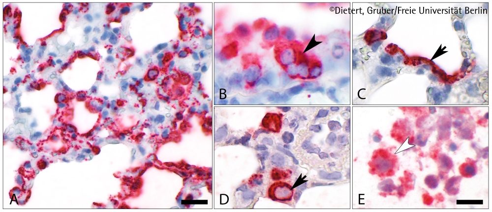 Lungenschäden bei COVID-19-Erkrankungen verstehen. Modell als Grundlage neuer therapeutischer Ansätze
