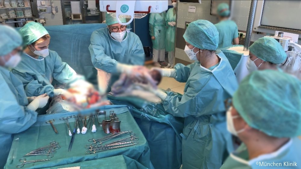 Erstversorgung Frühgeborener noch an der Nabelschnur