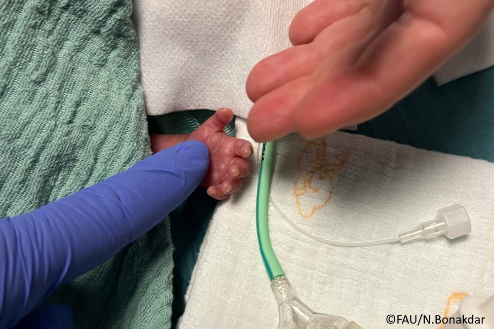 Intelligentes Absaugsystem schützt Frühgeborene