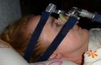 Eine nicht-invasive Beatmung ist der invasiven Beatmung aus mehreren Gründen vorzuziehen