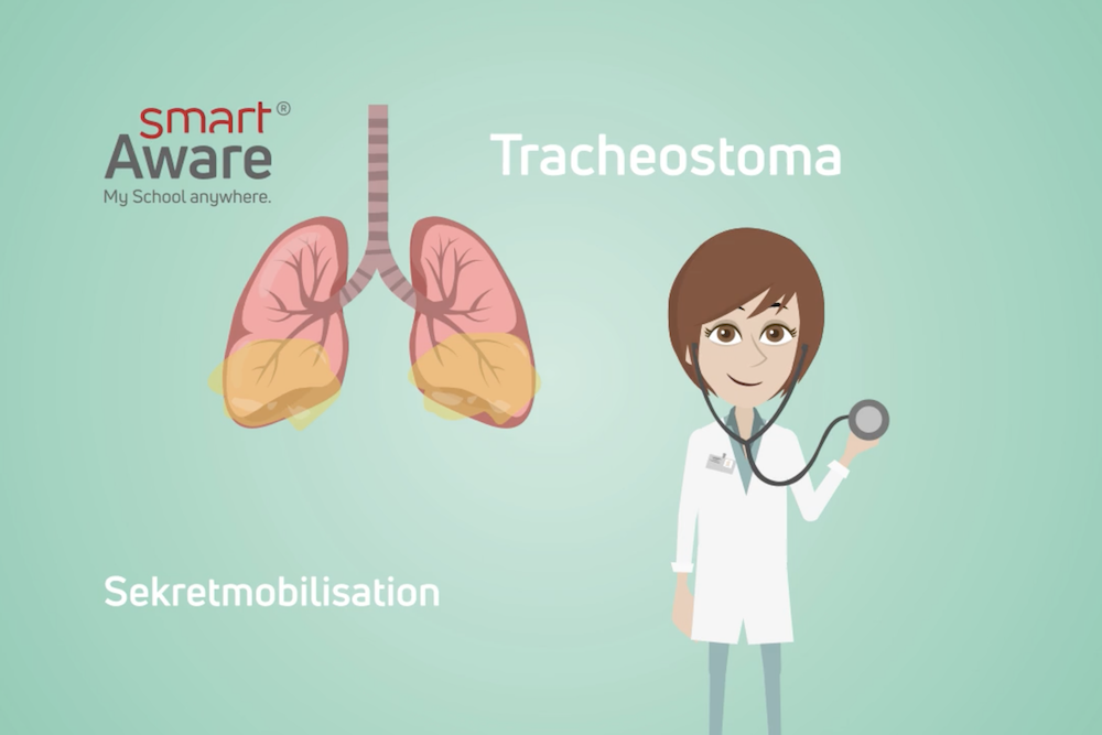 Jetzt online schulen: Sekretmobilisation bei Tracheostoma