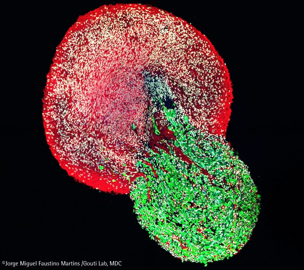 Europäischer Forschungsrat fördert Entwicklung neuromuskulärer Organoide