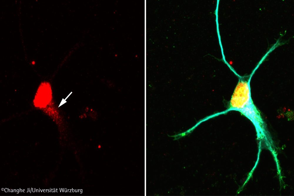 Signalweg in Nervenzellen entschlüsselt