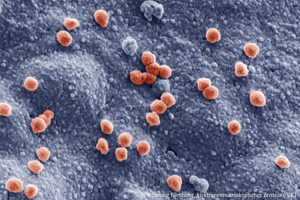 COVID-19-Atlas der Gewebeschäden und Viruslast in Organen