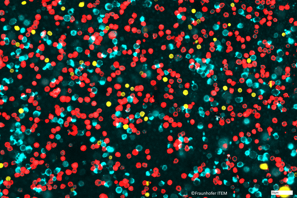 Immun-Check für die Lunge