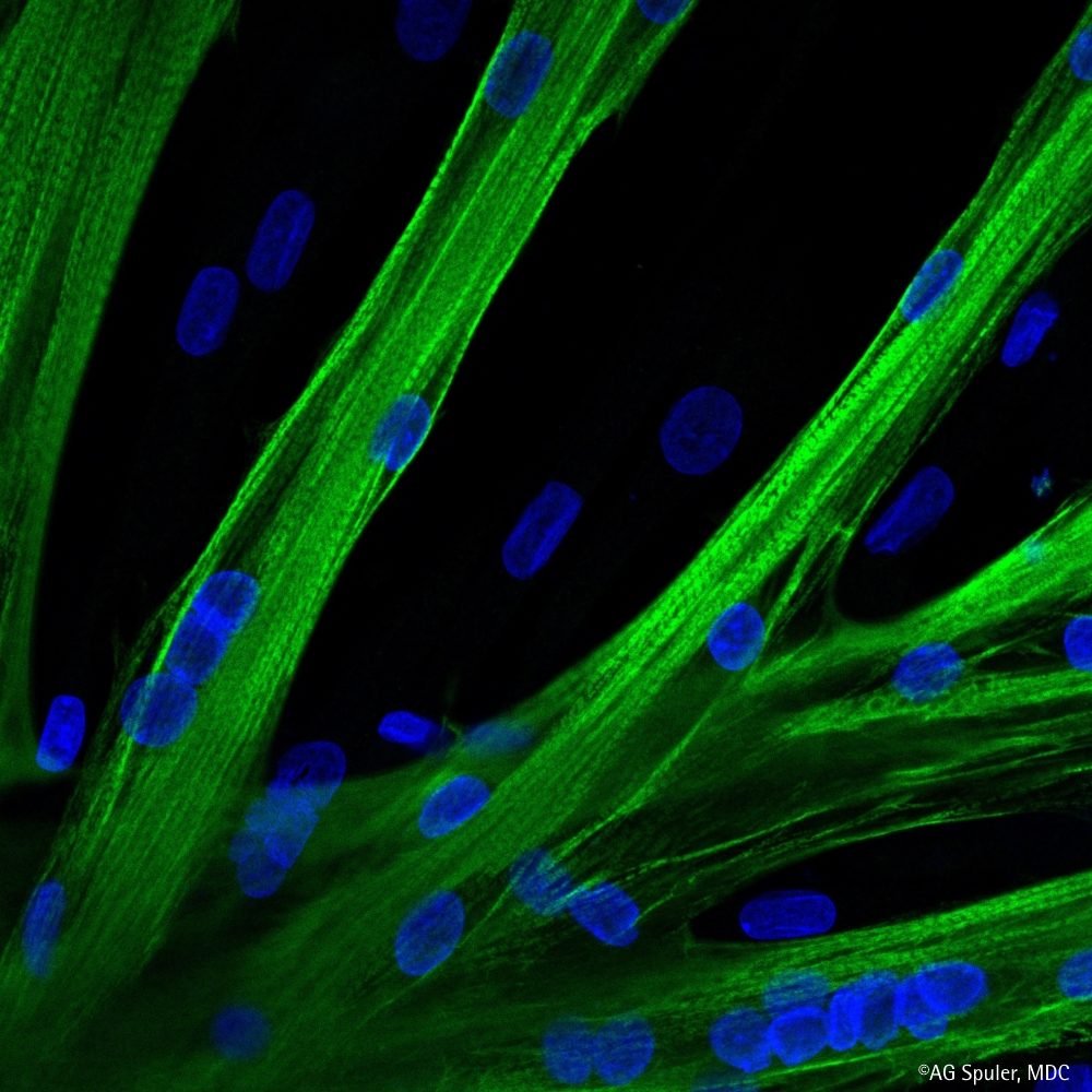 Mit mRNA zu neuer Muskelkraft