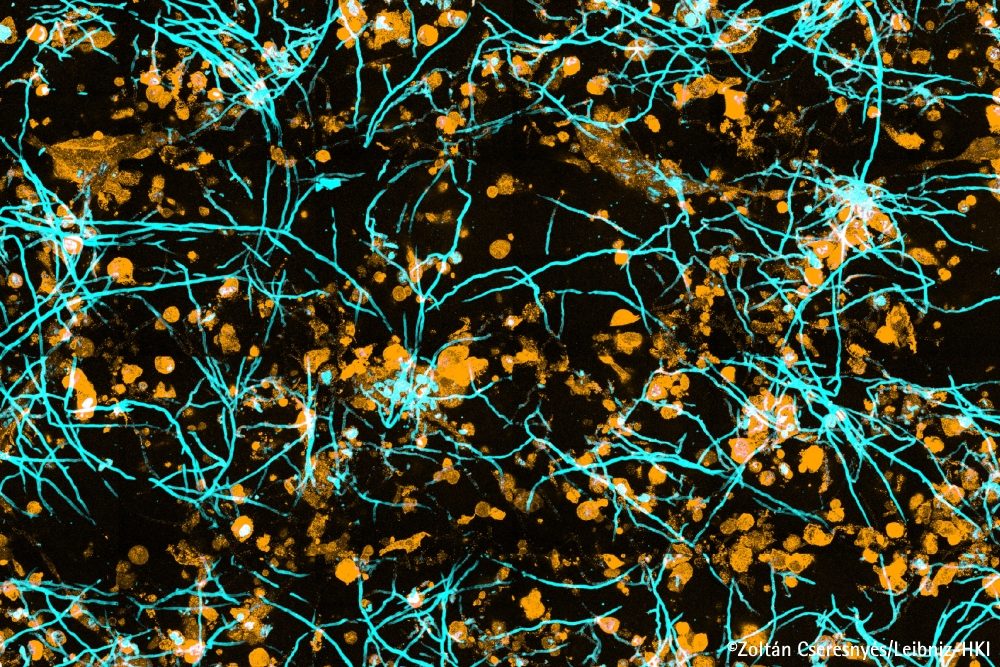 Wie breiten sich Pilzinfektionen in der Lunge aus?